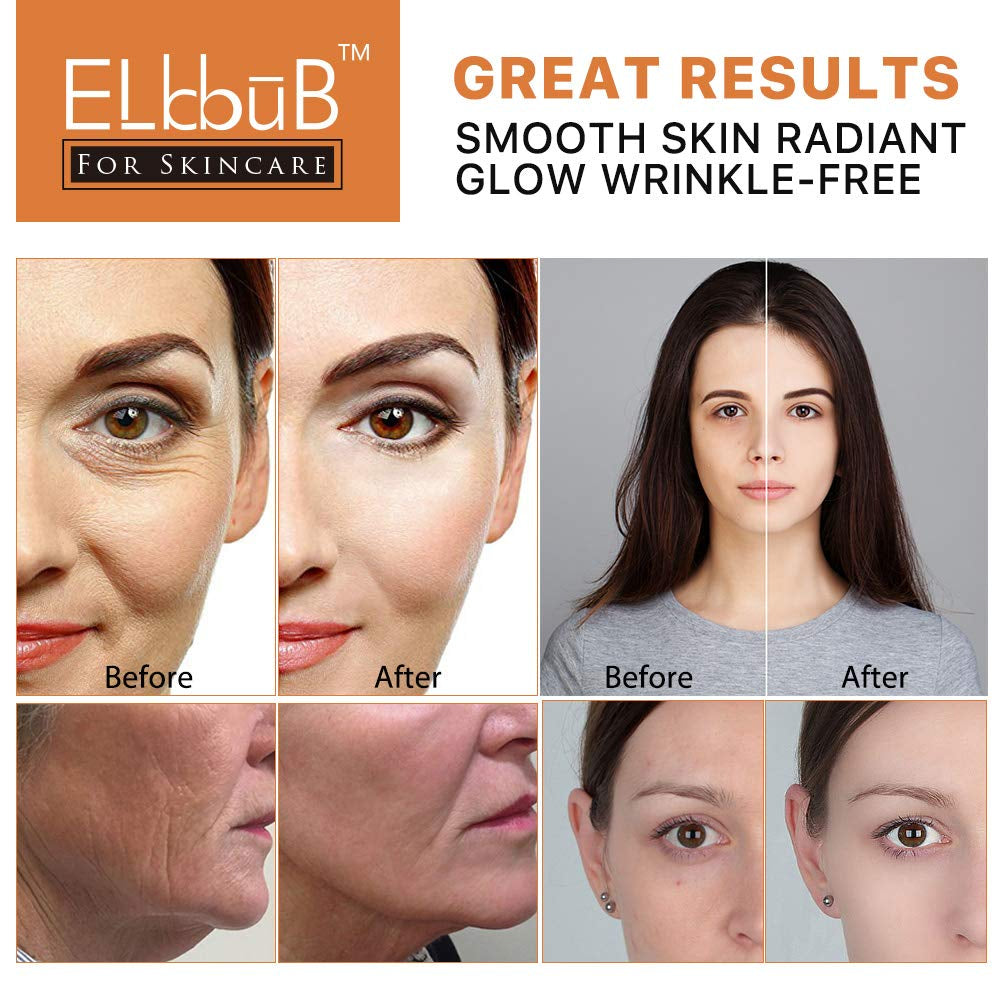 Premium 20% Vitamin C Serum for Face with Hyaluronic Acid, Retinol & Amino Acids - Boost Skin Collagen,Hydrate & Plump Skin, anti Aging & Wrinkle Facial Serum